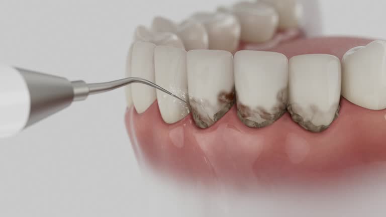 Reliable Emergency Dentist contractor in Colbert, OK by Smile Center Dentistry
